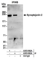 Synaptojanin 2 Antibody in Western Blot (WB)