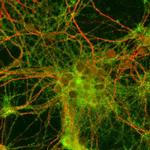 Synaptophysin Antibody in Immunocytochemistry (ICC/IF)