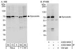 Synoviolin Antibody in Western Blot (WB)