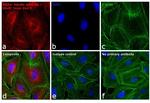 Rat IgG (H+L) Cross-Adsorbed Secondary Antibody in Immunocytochemistry (ICC/IF)