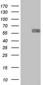 CD4 Antibody in Western Blot (WB)