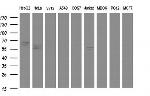 Alpha 1 Fetoprotein Antibody in Western Blot (WB)