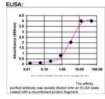 Amphiphysin Antibody in ELISA (ELISA)