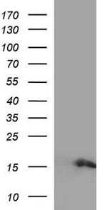 Retinol Binding Protein RBP Antibody in Western Blot (WB)