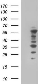 WIPF1/WIP Antibody in Western Blot (WB)