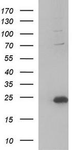 IL1RN/IL1RA Antibody in Western Blot (WB)