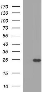 IL1RN/IL1RA Antibody in Western Blot (WB)