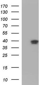 HOXA5 Antibody in Western Blot (WB)