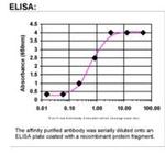 PSCA Antibody in ELISA (ELISA)