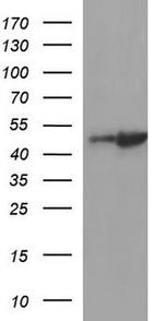 LIM1 Antibody in Western Blot (WB)