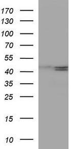 ELK1 Antibody in Western Blot (WB)