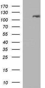 EPH Receptor A2 Antibody in Western Blot (WB)