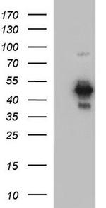 Coxsackie Adenovirus Receptor Antibody in Western Blot (WB)