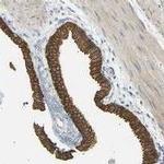 TBC1D8 Antibody in Immunohistochemistry (Paraffin) (IHC (P))