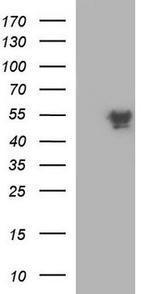 Cleavage Stimulation Factor Antibody in Western Blot (WB)