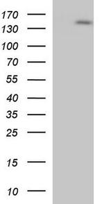 eNOS Antibody in Western Blot (WB)