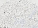 HNF1-Beta (HNF1B) Antibody in Immunohistochemistry (Paraffin) (IHC (P))