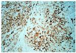 ALK Antibody in Immunohistochemistry (IHC)