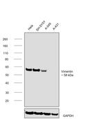 VIM Antibody in Western Blot (WB)