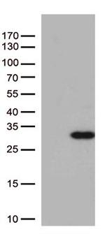 RAB5A Antibody in Western Blot (WB)