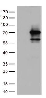 SEPT9 Antibody in Western Blot (WB)