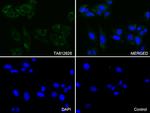 Syntaxin 1a (STX1A) Antibody in Immunocytochemistry (ICC/IF)