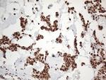 EWSR1 Antibody in Immunohistochemistry (Paraffin) (IHC (P))