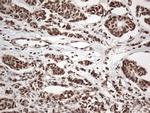 EWSR1 Antibody in Immunohistochemistry (Paraffin) (IHC (P))