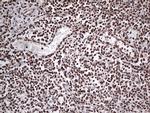 EWSR1 Antibody in Immunohistochemistry (Paraffin) (IHC (P))