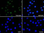 EWSR1 Antibody in Immunocytochemistry (ICC/IF)