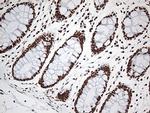 EWSR1 Antibody in Immunohistochemistry (Paraffin) (IHC (P))