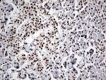 EWSR1 Antibody in Immunohistochemistry (Paraffin) (IHC (P))