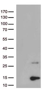 Pancreatic Polypeptide (PPY) Antibody in Western Blot (WB)