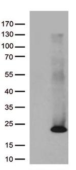 ASF1B Antibody in Western Blot (WB)