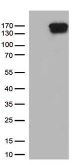 TRPS1 Antibody in Western Blot (WB)