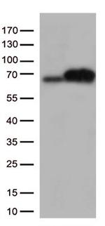 EIF2AK2 Antibody in Western Blot (WB)