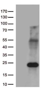 MYL9 Antibody in Western Blot (WB)