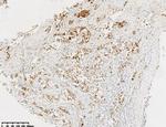 GCDFP-15 Antibody in Immunohistochemistry (Paraffin) (IHC (P))