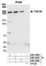 TAB182 Antibody in Western Blot (WB)