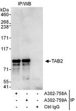 TAB2 Antibody in Immunoprecipitation (IP)