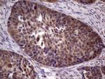 TACC1 Antibody in Immunohistochemistry (Paraffin) (IHC (P))