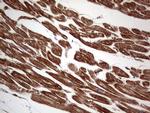 TACC2 Antibody in Immunohistochemistry (Paraffin) (IHC (P))