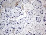 TACC2 Antibody in Immunohistochemistry (Paraffin) (IHC (P))