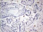 TACC2 Antibody in Immunohistochemistry (Paraffin) (IHC (P))