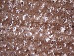 TACC2 Antibody in Immunohistochemistry (Paraffin) (IHC (P))