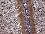 TACC2 Antibody in Immunohistochemistry (Paraffin) (IHC (P))