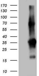 TACC2 Antibody in Western Blot (WB)