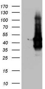 TACC2 Antibody in Western Blot (WB)