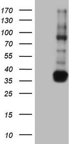 TACC2 Antibody in Western Blot (WB)