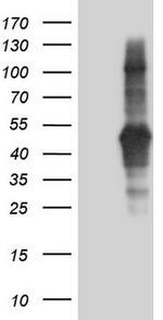 TACC2 Antibody in Western Blot (WB)